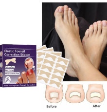 Пластир Для НІГТІВ , що коректують наклейки для нігтів 9388--2 (1000)