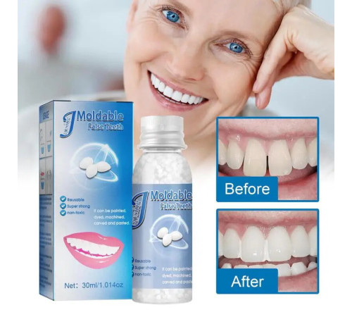 Клей для ремонта зубов, устройство для временного наполнения искусственных зубов, (574)